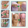 Tratamiento Anti Hongos 100% Natural 7 Días